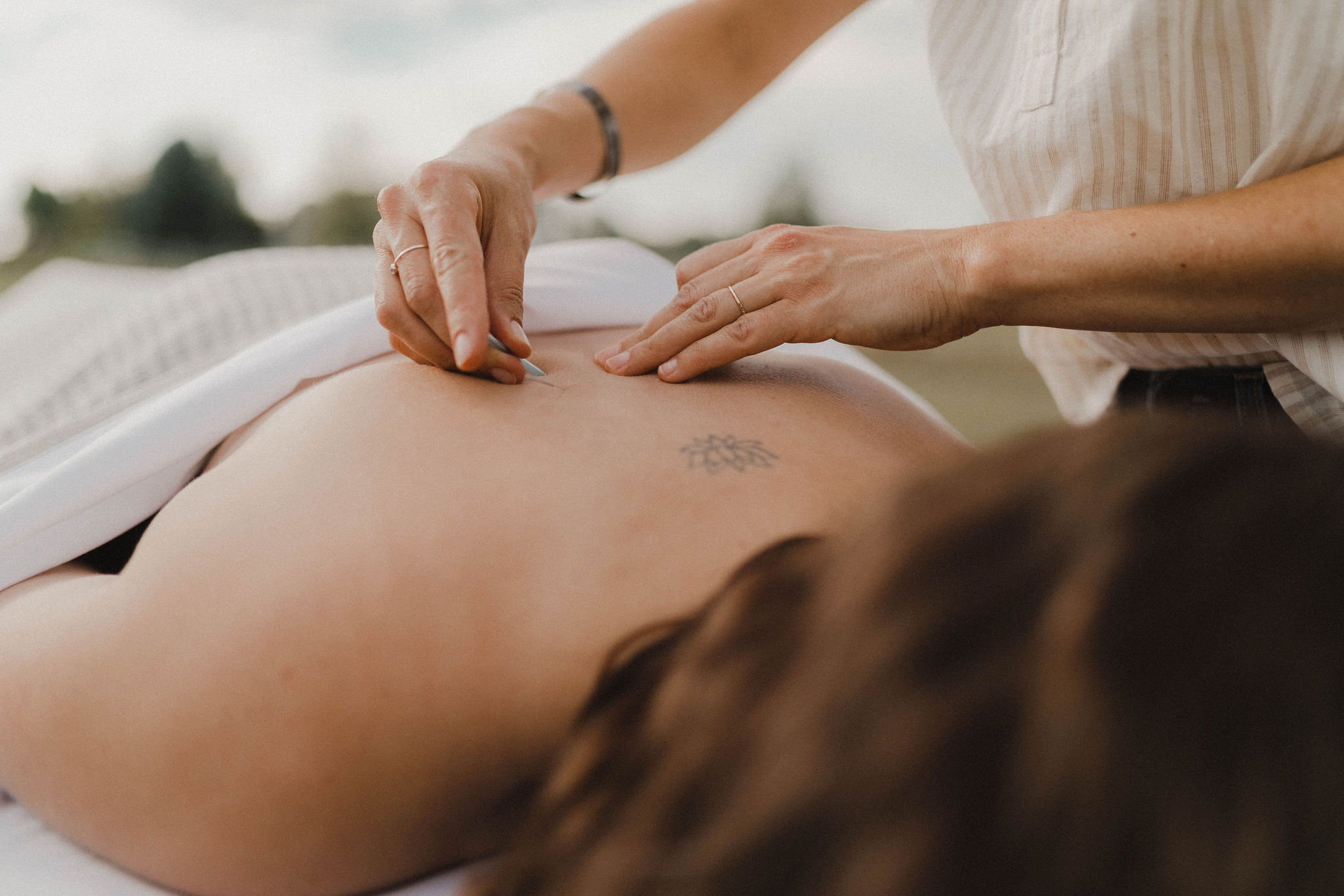 What to Expect During Your First Acupuncture Session